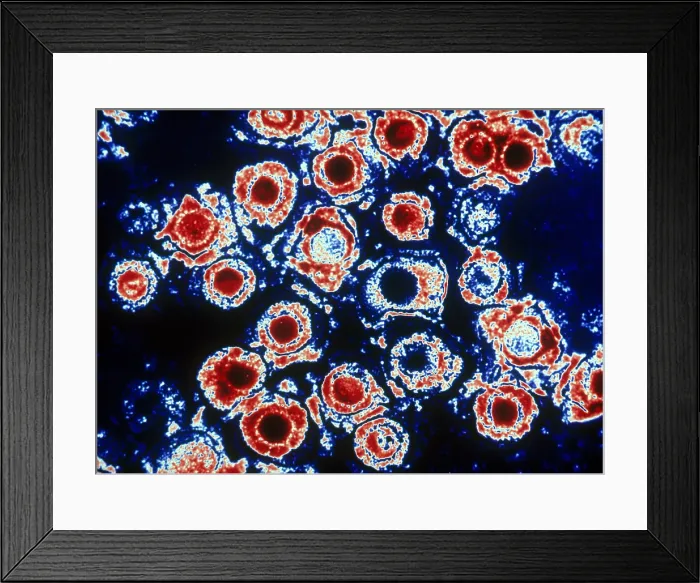Framed Print : Herpes Simplex Virus (TEM) Framed Print : Herpes Simplex Virus (TEM)