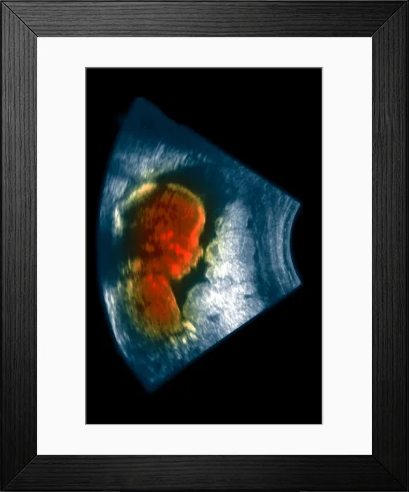 Framed Print : Ultrasound of a 5 month old fetus Framed Print : Ultrasound of a 5 month old fetus