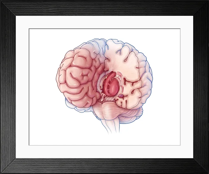 Framed Print : Limbic System, Illustration Framed Print : Limbic System, Illustration