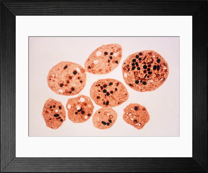Framed Print : Platelets, TEM Framed Print : Platelets, TEM
