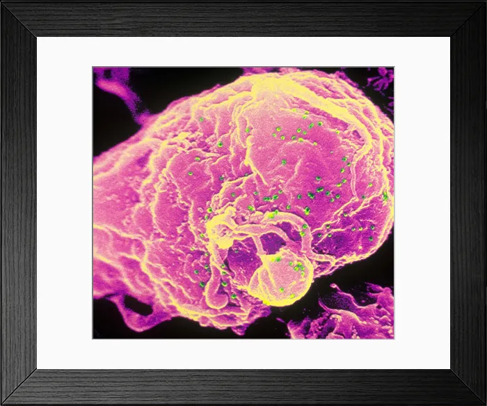 Framed Print : HIV-1 Infected T4 Lymphocyte (SEM) Framed Print : HIV-1 Infected T4 Lymphocyte (SEM)