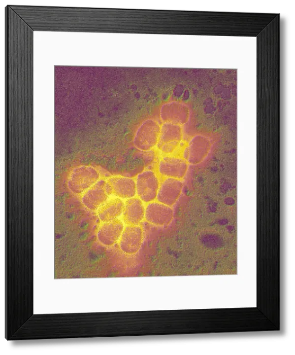 Framed Print : Smallpox virus