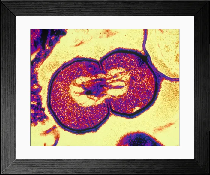 Framed Print : Bacterial Cell Undergoing Fission (TEM) Framed Print : Bacterial Cell Undergoing Fission (TEM)