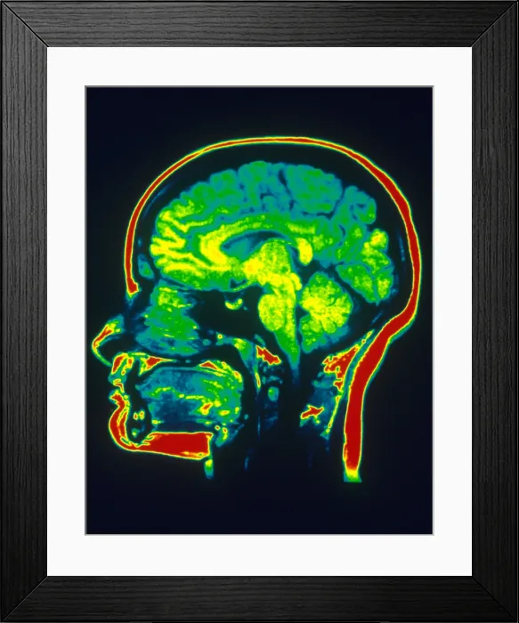 Framed Print : MRI of Brain Framed Print : MRI of Brain