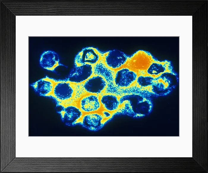 Framed Print : TEM of Rubella (German Measles) Framed Print : TEM of Rubella (German Measles)