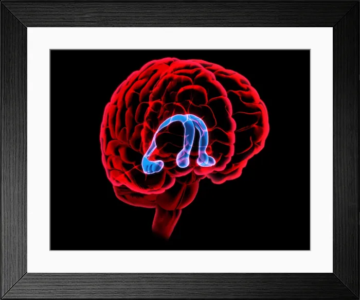Framed Print : Hippocampus and Fornix Framed Print : Hippocampus and Fornix