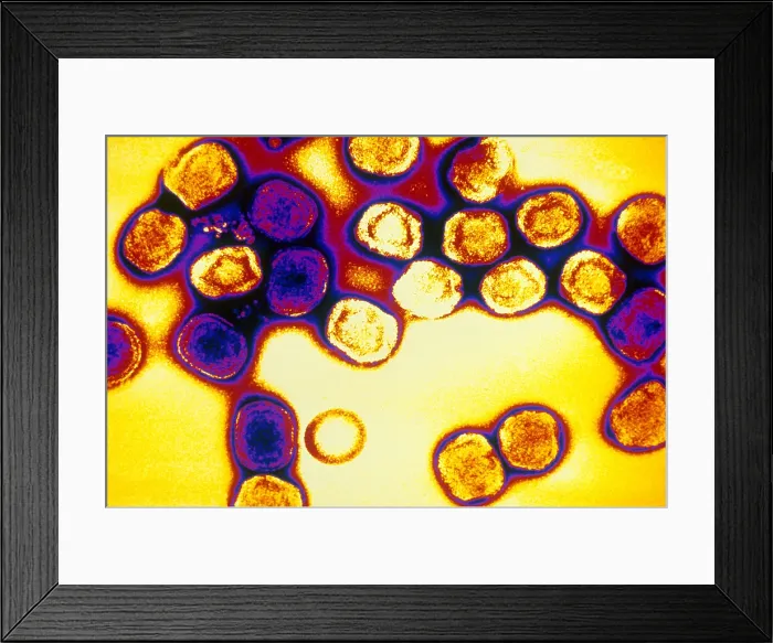 Framed Print : TEM of Vaccinia Virus