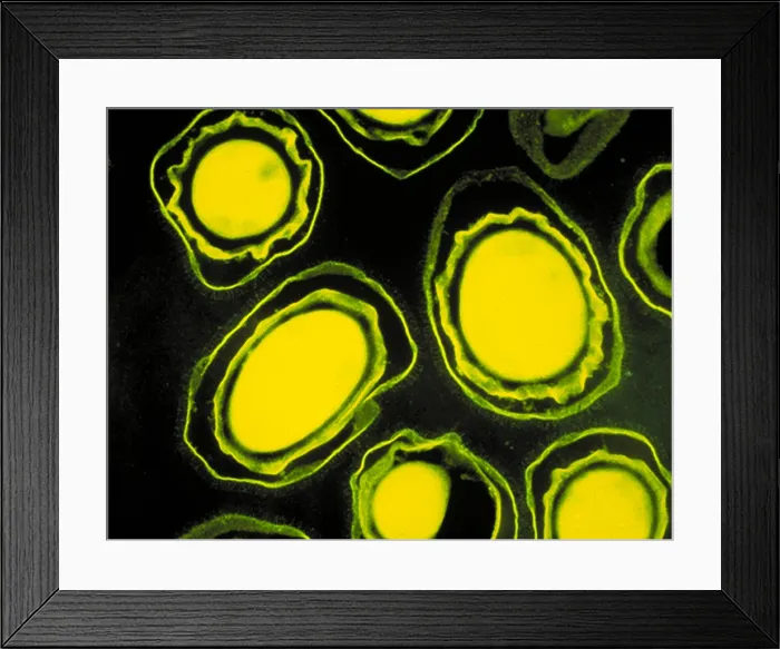 Framed Print : Anthrax spores Framed Print : Anthrax spores