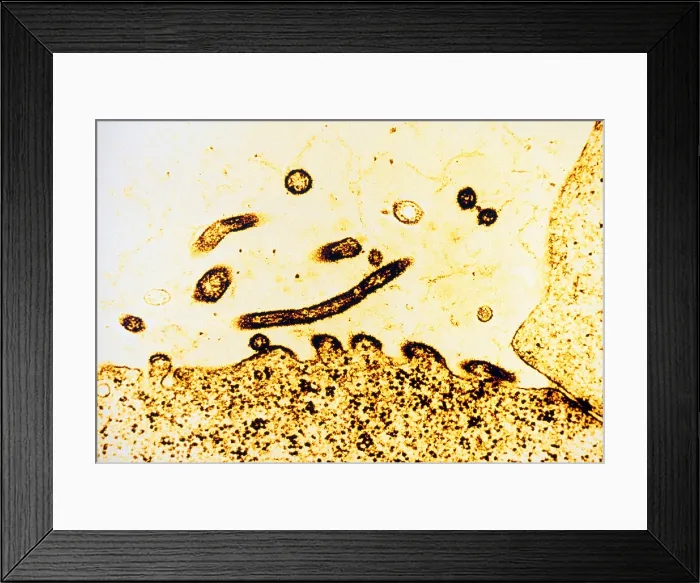 Framed Print : TEM of Respiratory Syncytial Virus Framed Print : TEM of Respiratory Syncytial Virus