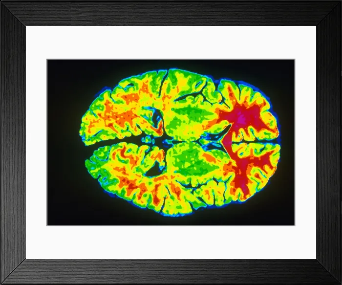Framed Print : Human Brain Framed Print : Human Brain