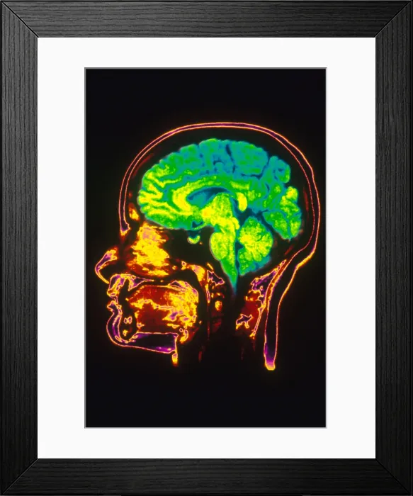 Framed Print : MRI of Head Framed Print : MRI of Head