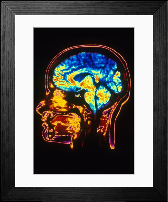 Framed Print : MRI of Head Framed Print : MRI of Head