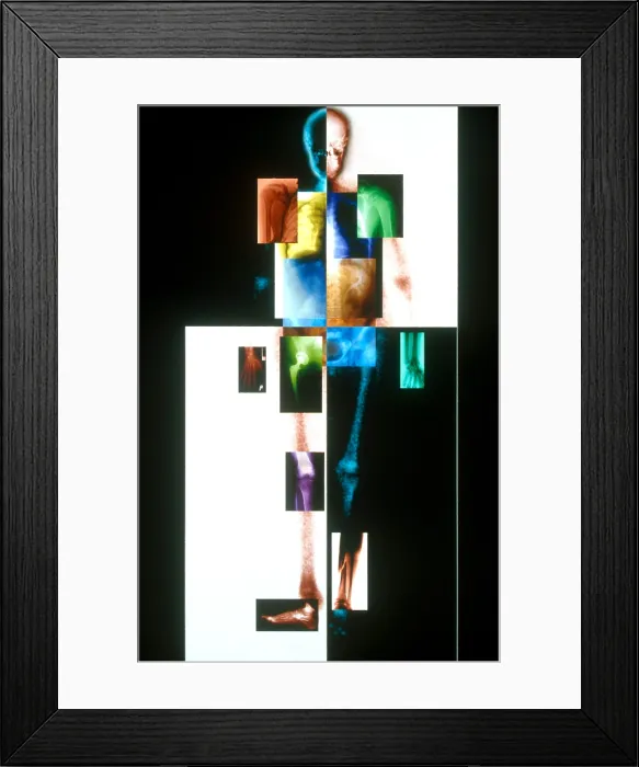 Framed Print : Medical Imaging Montage
