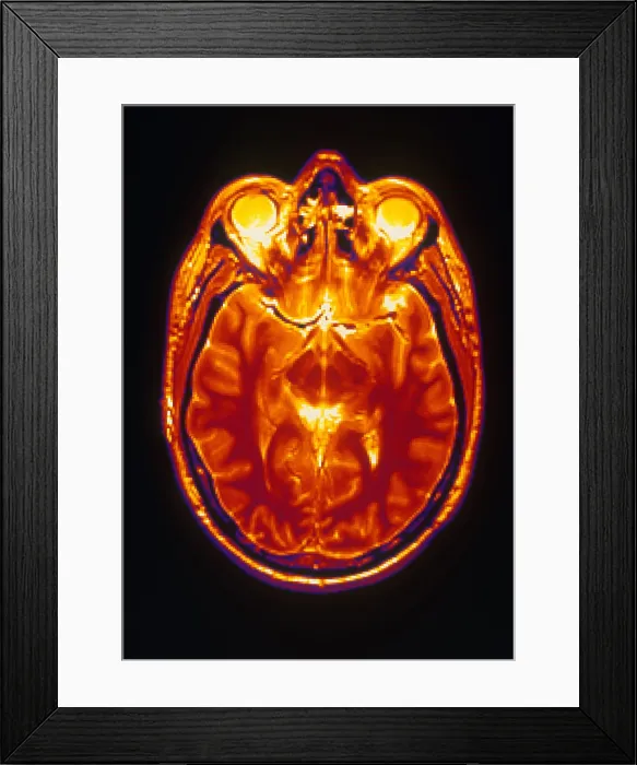 Framed Print : MRI of Brain