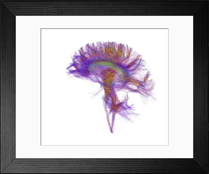 Framed Print : Brain, Fiber Tractography Image