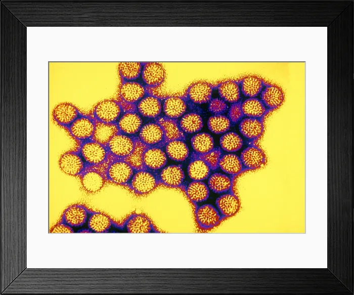 Framed Print : TEM of Rotavirus Framed Print : TEM of Rotavirus