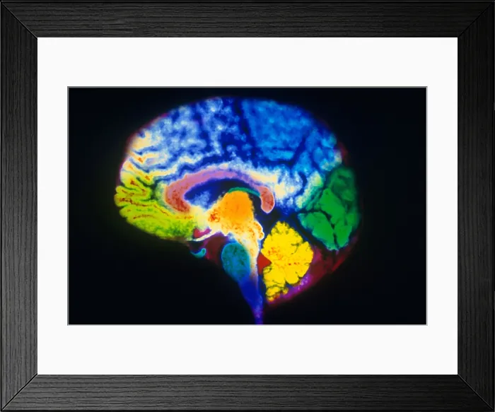 Framed Print : MRI of Brain Framed Print : MRI of Brain
