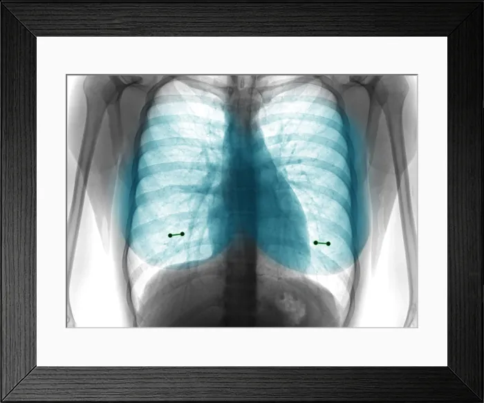 Framed Print : Nipple Piercings Framed Print : Nipple Piercings