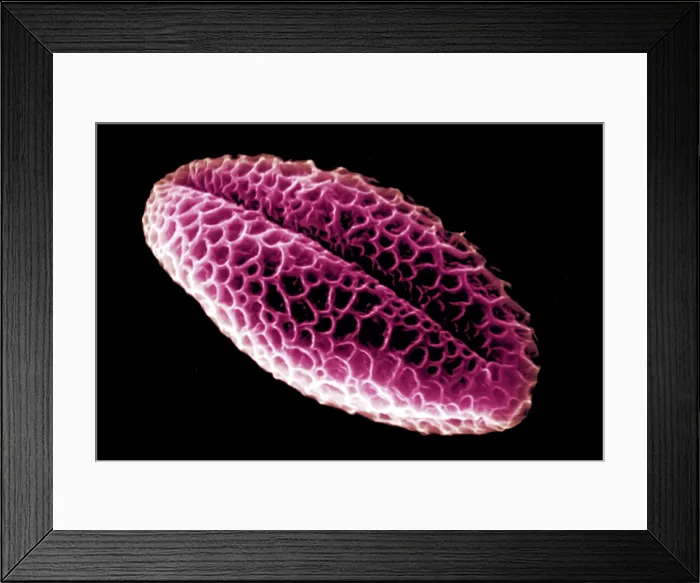 Framed Print : Pussy Willow Pollen Grains Framed Print : Pussy Willow Pollen Grains