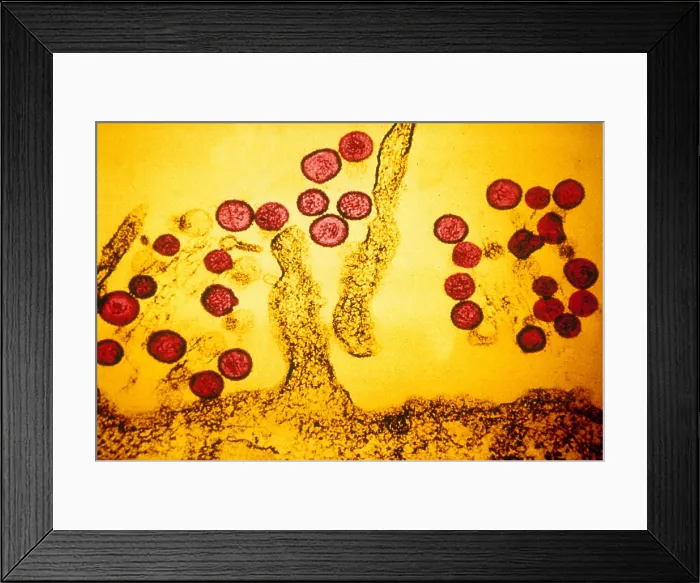 Framed Print : Hanta Virus (TEM)