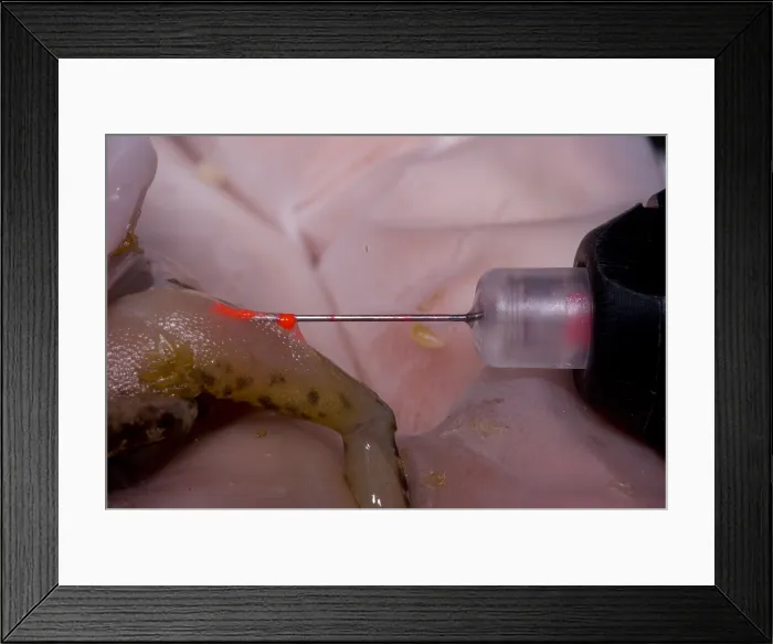 Framed Print : Acrylic elastomer injection Framed Print : Acrylic elastomer injection