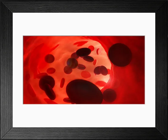Framed Print : Red Blood Cells Framed Print : Red Blood Cells