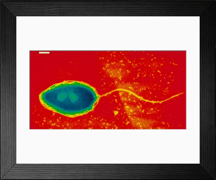 Framed Print : Pseudomonas cepacea Framed Print : Pseudomonas cepacea