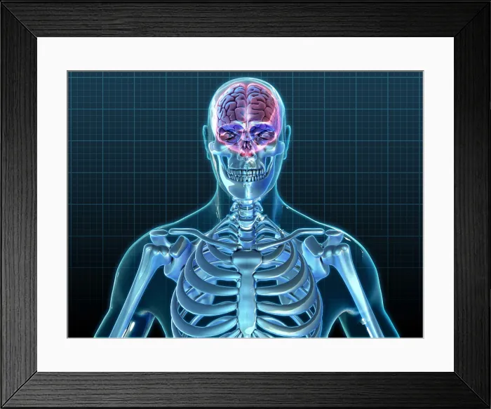 Framed Print : Human Skeleton and Brain, artwork Framed Print : Human Skeleton and Brain, artwork