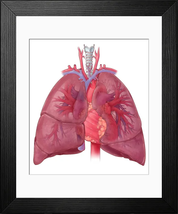 Framed Print : Heart and Lung Anatomy, Illustration Framed Print : Heart and Lung Anatomy, Illustration