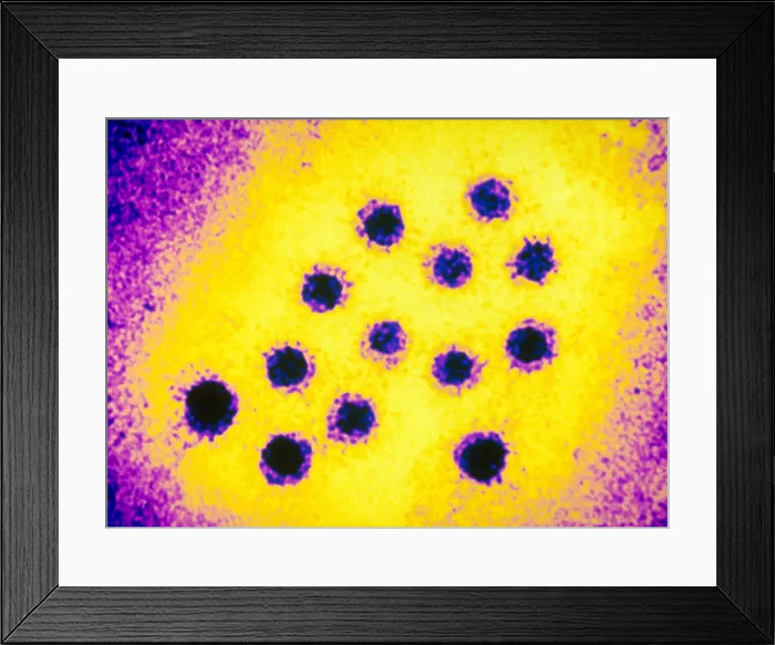 Framed Print : Hepatitis A Virus (TEM) Framed Print : Hepatitis A Virus (TEM)