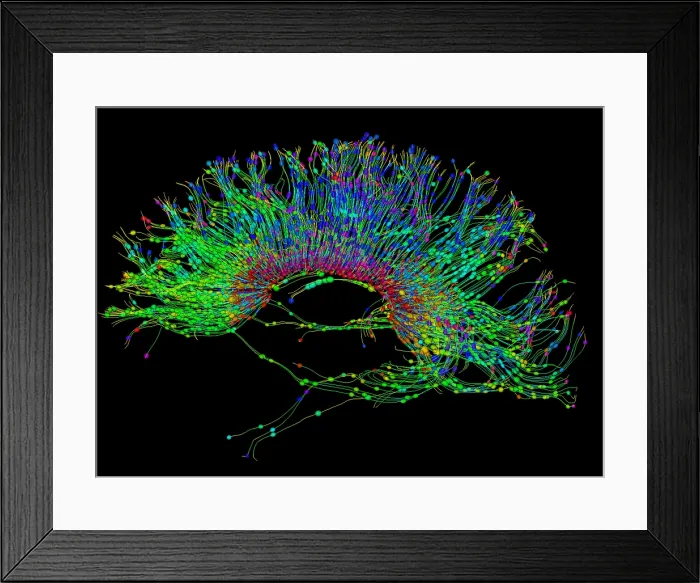 Framed Print : Brain, Fiber Tractography Image Framed Print : Brain, Fiber Tractography Image