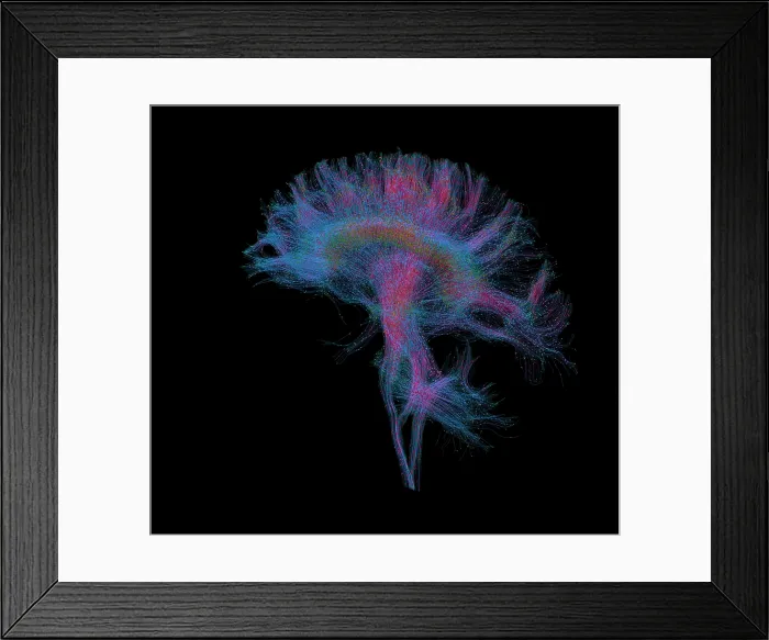 Framed Print : Brain, Fiber Tractography Image