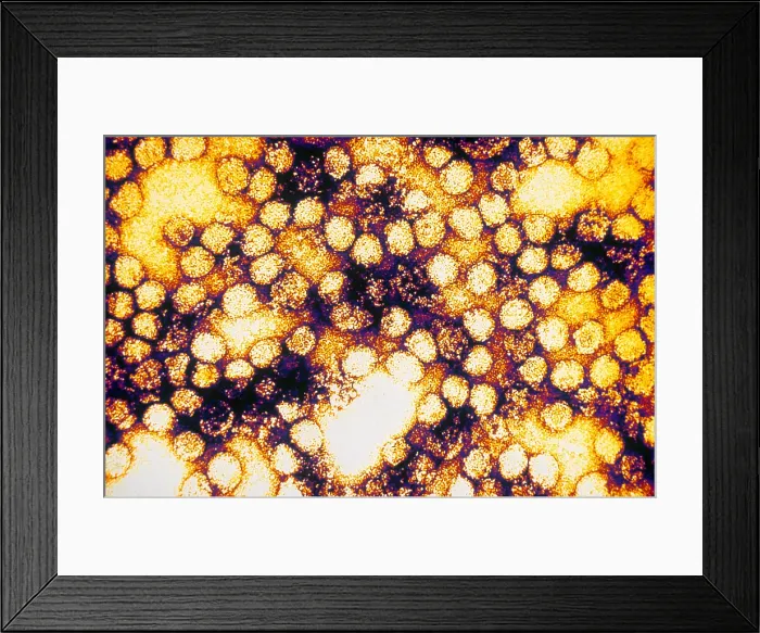 Framed Print : TEM of Yellow Fever