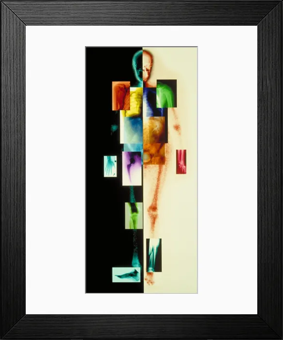 Framed Print : Composite of body Framed Print : Composite of body