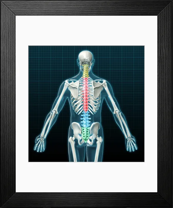 Framed Print : Vertebral Column, Illustration Framed Print : Vertebral Column, Illustration