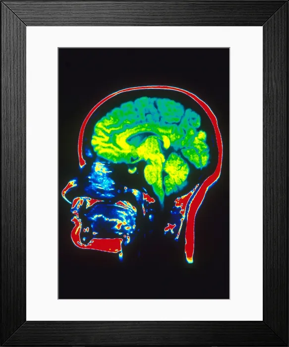 Framed Print : MRI of Head Framed Print : MRI of Head