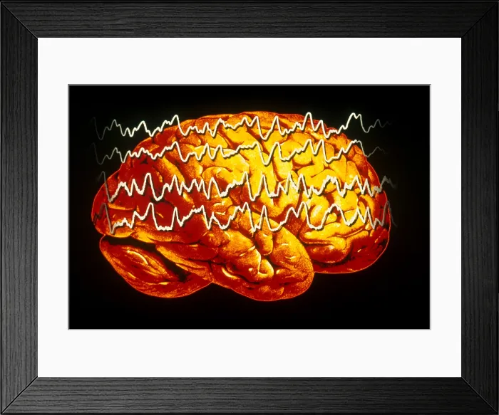Framed Print : EEG of Tonic-clonic Seizure Framed Print : EEG of Tonic-clonic Seizure