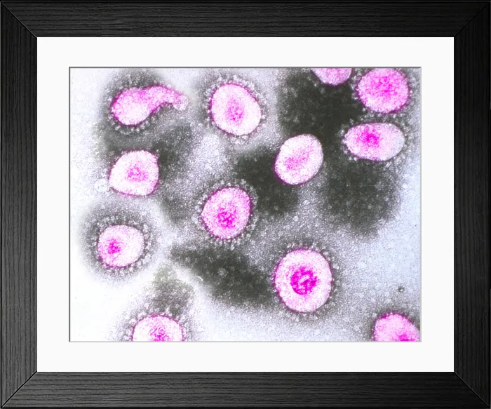 Framed Print : TEM of Coronavirus OC43