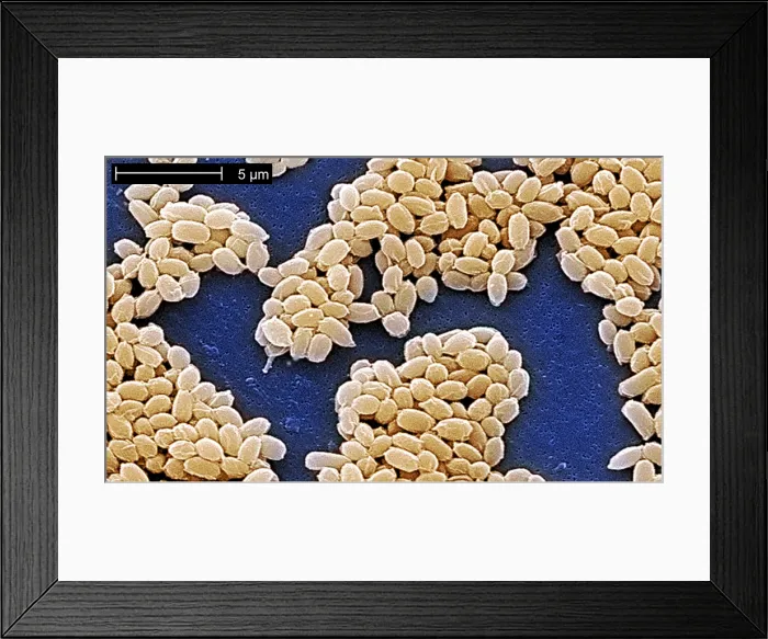 Framed Print : Anthrax spores Framed Print : Anthrax spores