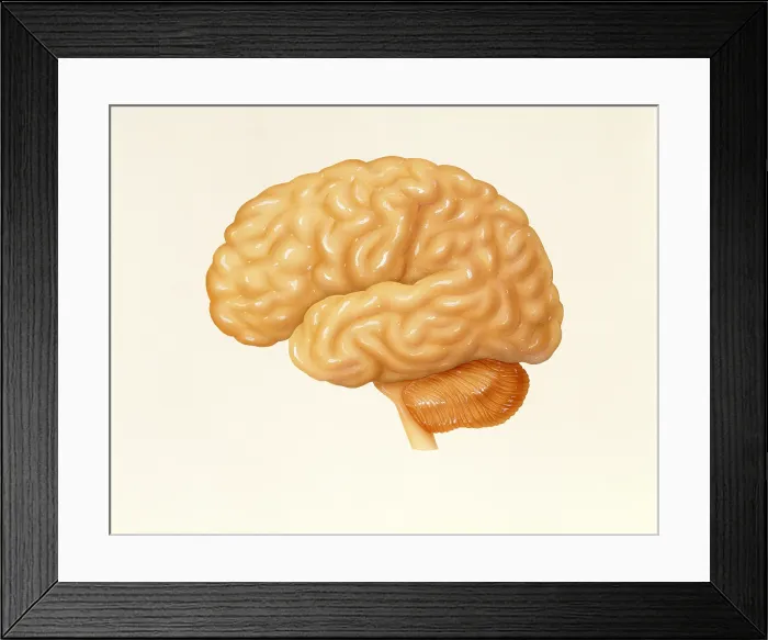 Framed Print : Human brain Framed Print : Human brain