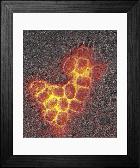Framed Print : Smallpox virus