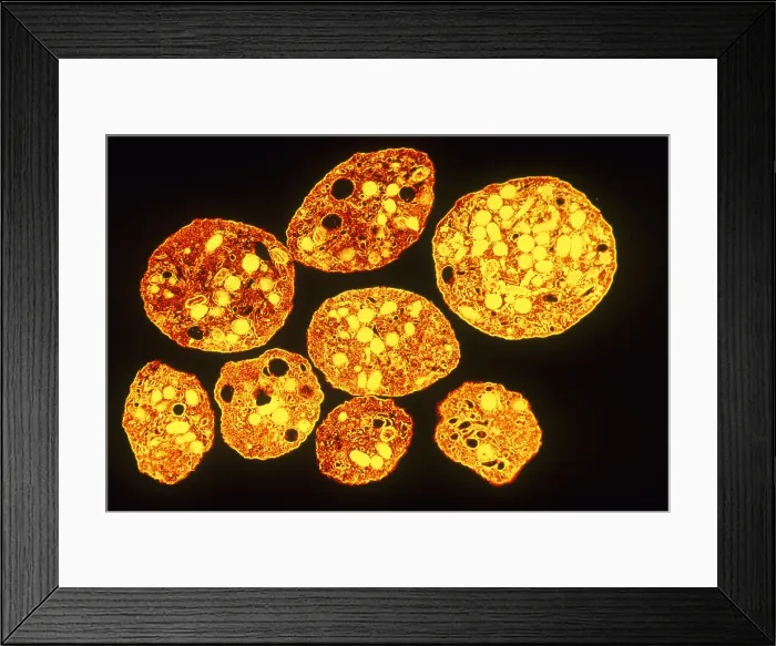 Framed Print : Platelets, TEM Framed Print : Platelets, TEM