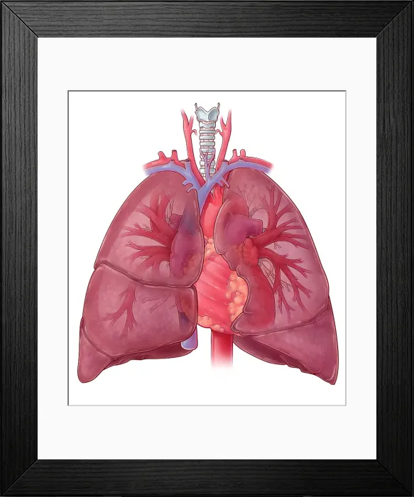 Framed Print : Heart Illustration, with Pulmonary Veins Framed Print : Heart Illustration, with Pulmonary Veins