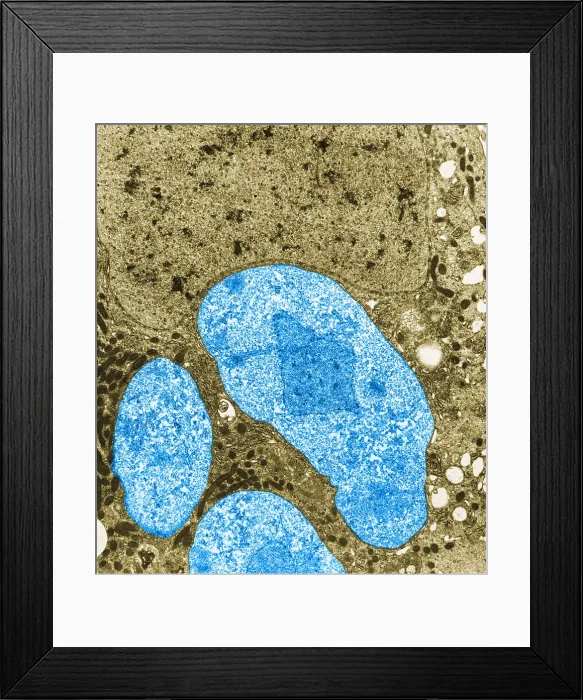 Framed Print : Nosema apis (TEM) Framed Print : Nosema apis (TEM)