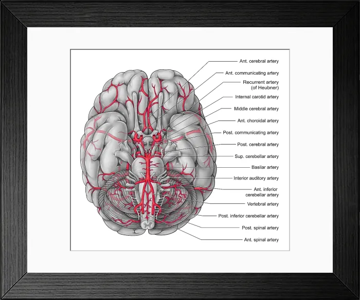 Framed Print : Arteries of the Brain, Illustration Framed Print : Arteries of the Brain, Illustration