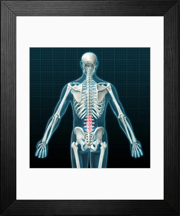 Framed Print : Lumbar Vertebrae, Illustration