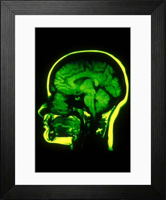 Framed Print : MRI of Head Framed Print : MRI of Head