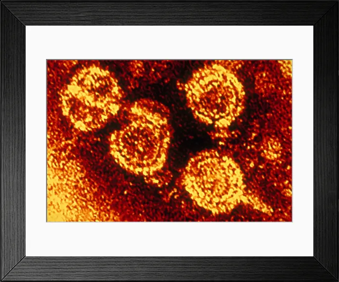 Framed Print : Hepatitis B Virus (TEM) Framed Print : Hepatitis B Virus (TEM)
