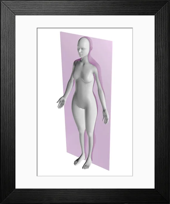 Framed Print : Coronal Plane Framed Print : Coronal Plane