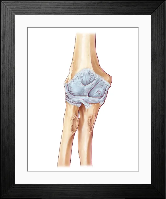 Framed Print : Ligaments of the Elbow Framed Print : Ligaments of the Elbow
